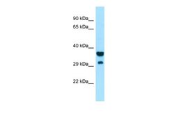 SIRP gamma/CD172g Rabbit anti-Human, Polyclonal, Novus Biologicals 0.1 mL | Buy Online | Novus Biologicals | Fisher Scientific